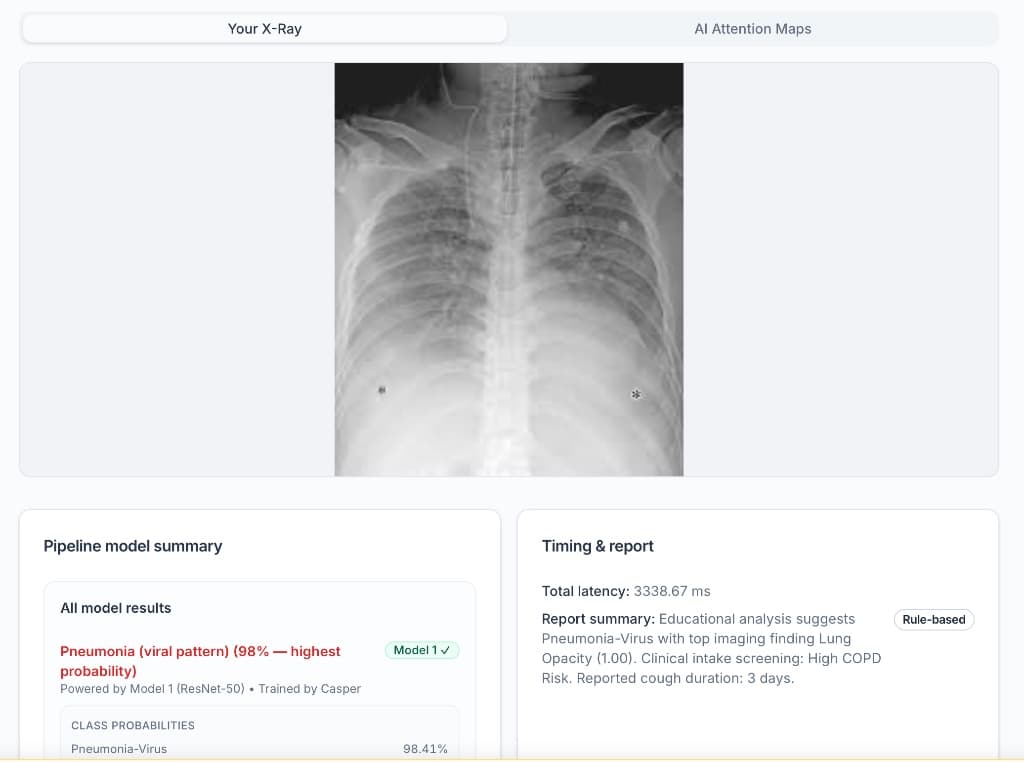 LungLens results page showing uploaded chest X-ray, pipeline model summary with pneumonia viral pattern probability, and timing report